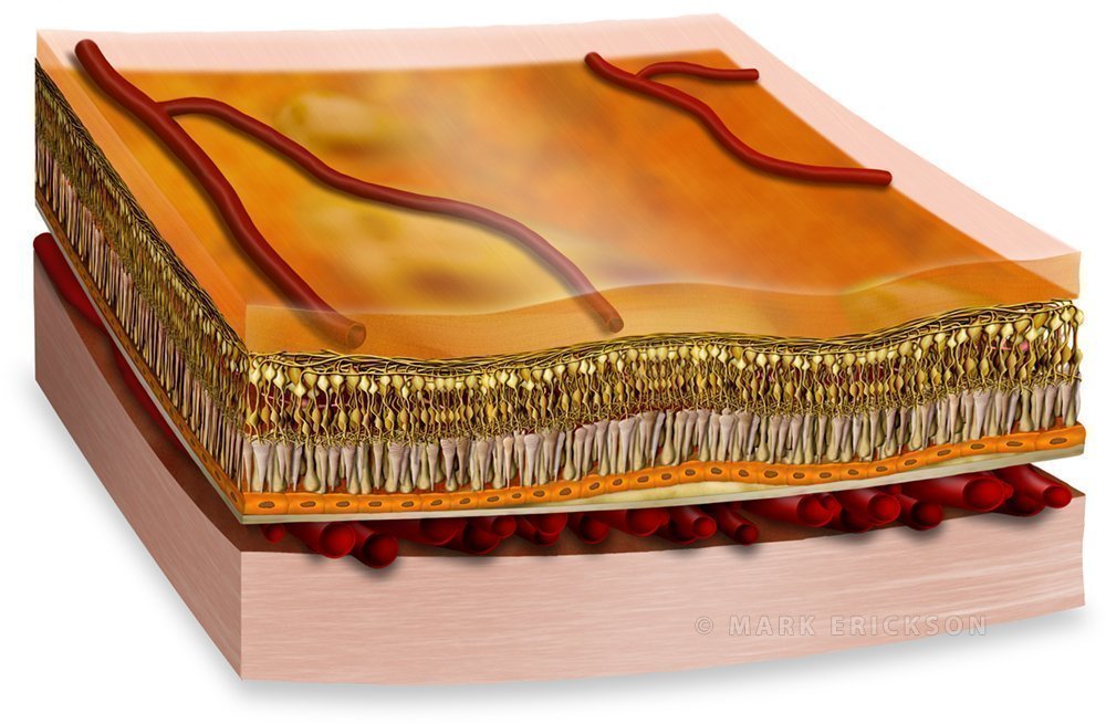 Drusen retinal layers cross section