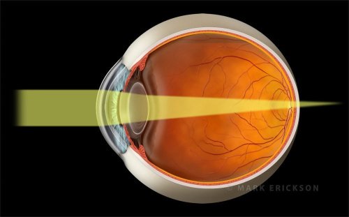 Hyperopic eye light rays illustration