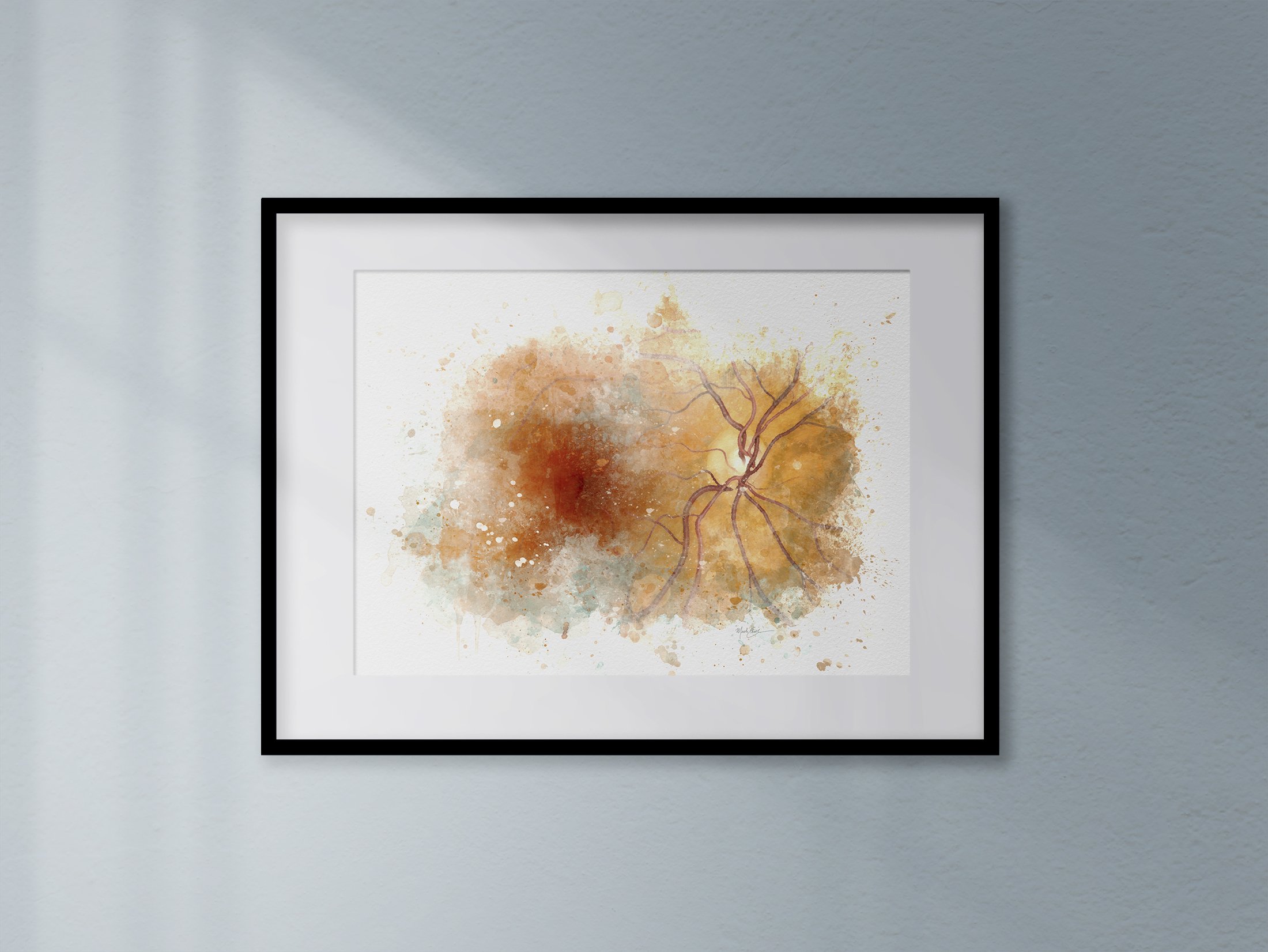 Retina anatomy art print for eye care offices and professional décor retina anatomy art optometry wall art print gift for optometrists