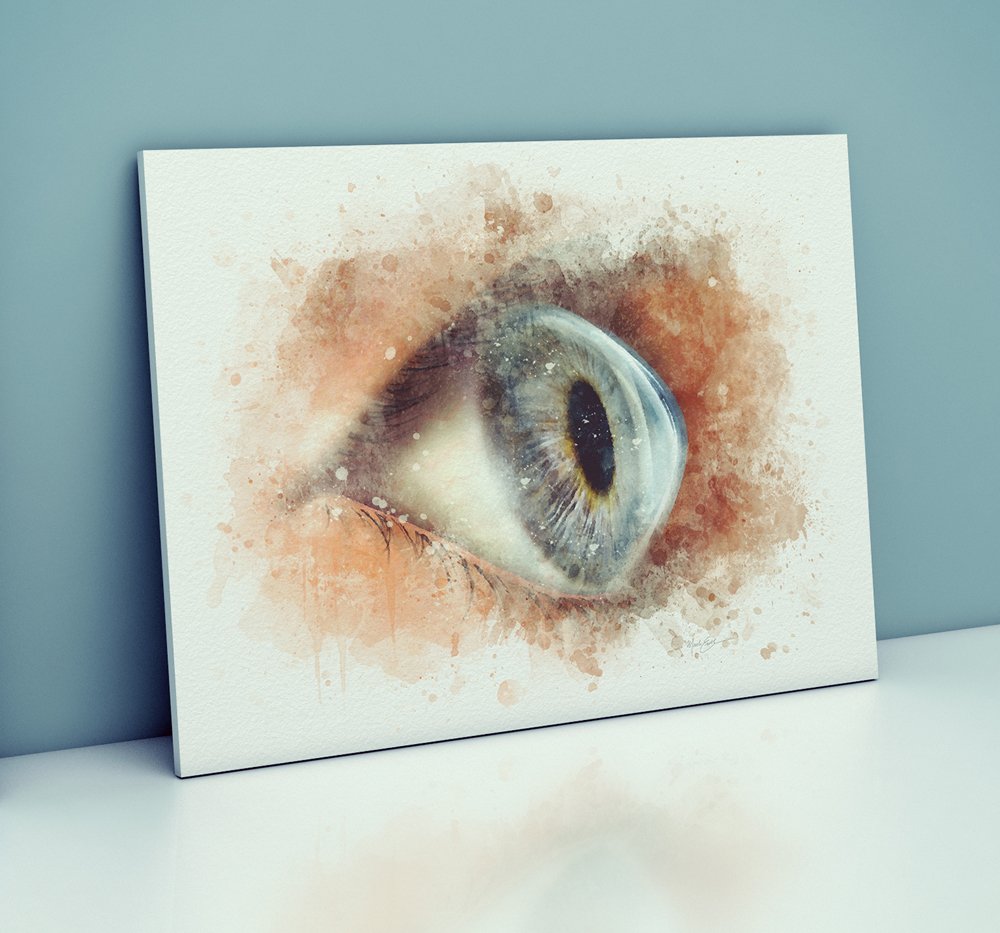 Keratoconus art – hand‑signed corneal art print - 106 keratoconus art Cornea doctor gift keratoconus art print