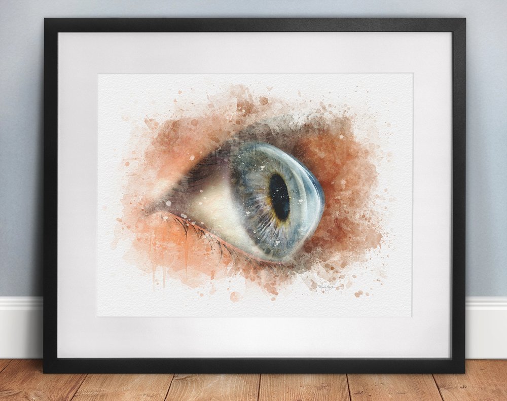 Keratoconus art print gift for eye doctors