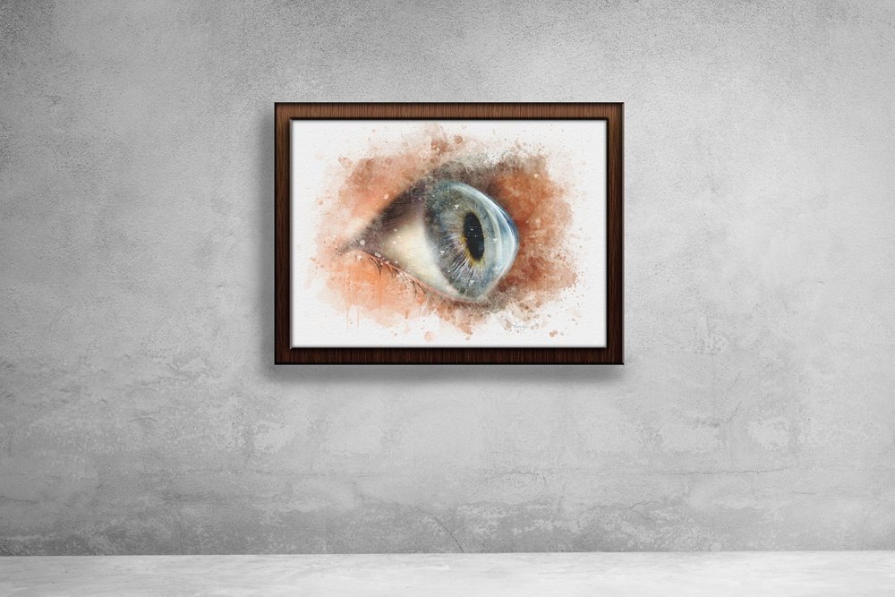 Keratoconus art – hand‑signed corneal art print - 106 keratoconus art Cornea specialist decor