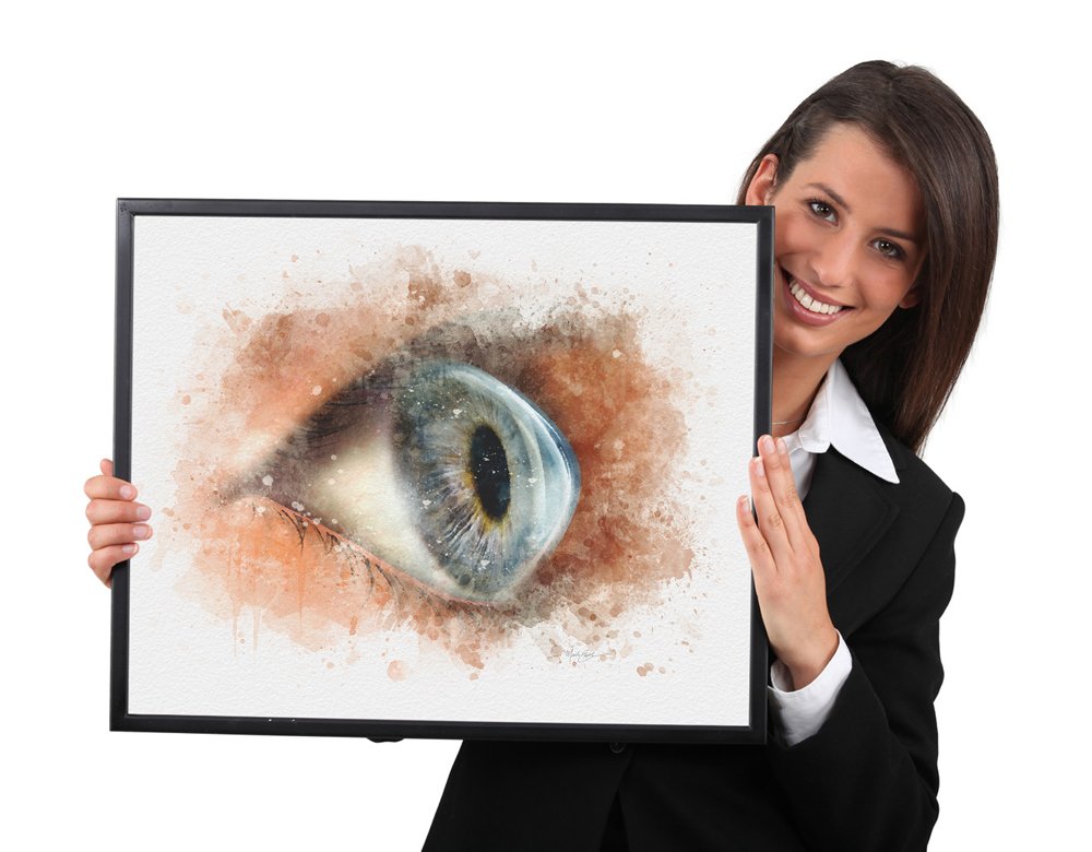 Keratoconus art – hand‑signed corneal art print - 106 keratoconus art Eye doctor wall art keratoconus art print