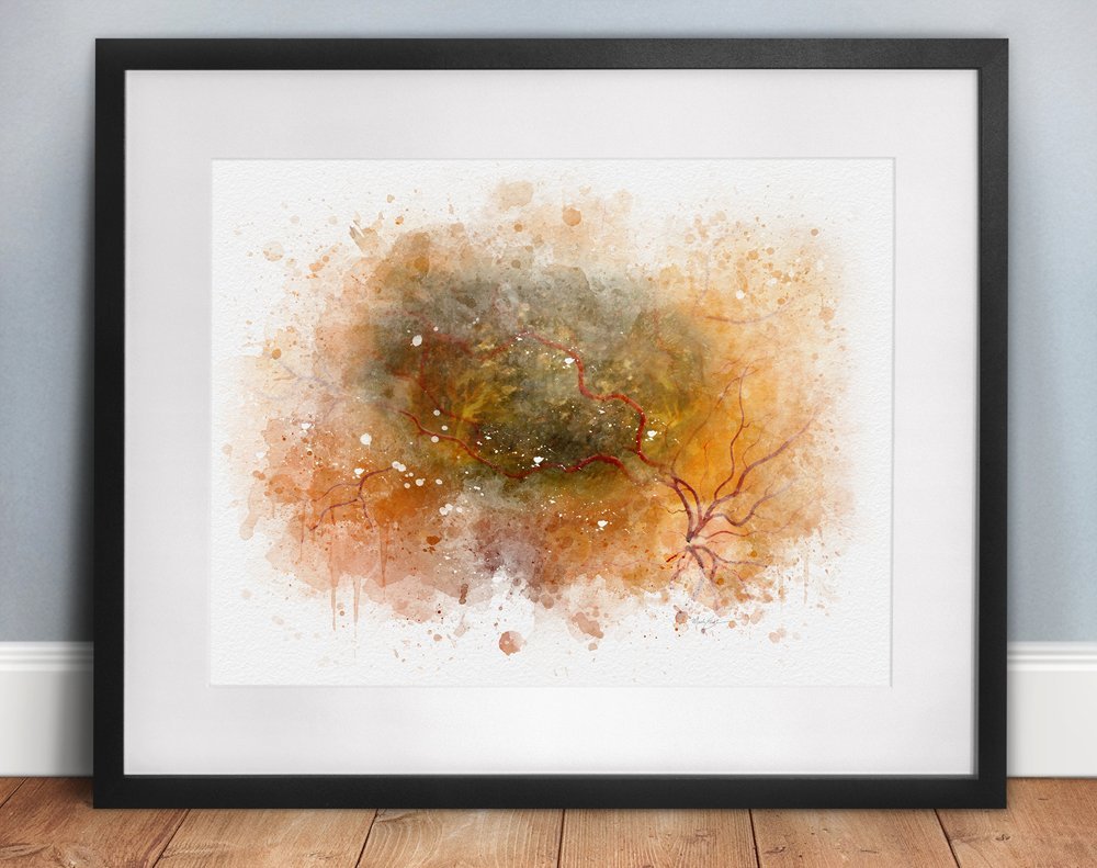 retina specialist decor art print