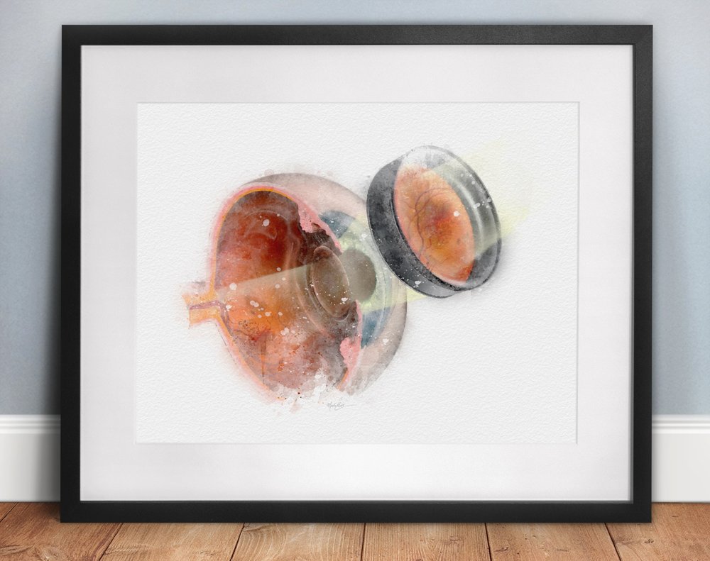 Ophthalmoscopy eye exam art