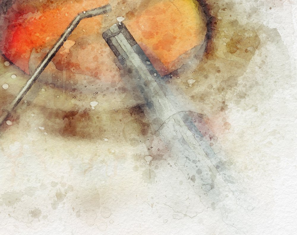 Cataract surgery art print for ophthalmology office decor cataract surgery art Gifts for cataract surgeon