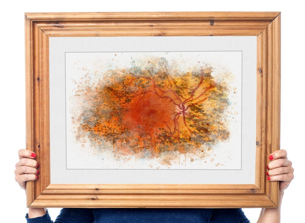 Retinitis pigmentosa art print - 301 retinitis pigmentosa Retina specialist wall art and decor