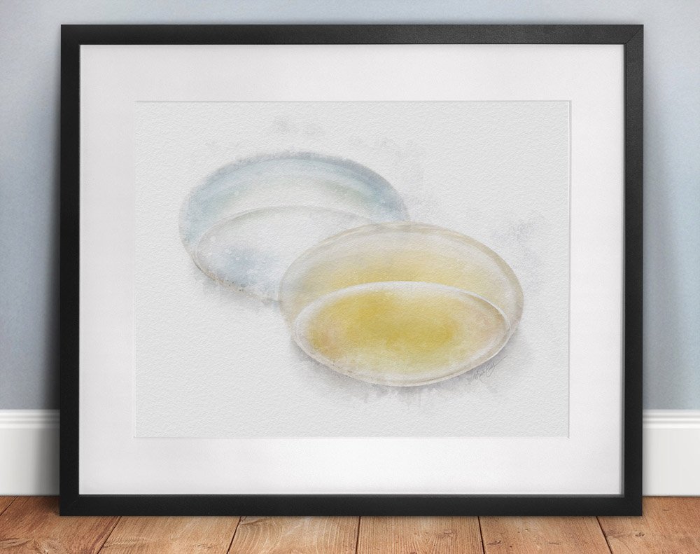 Cataract lens comparison art print
