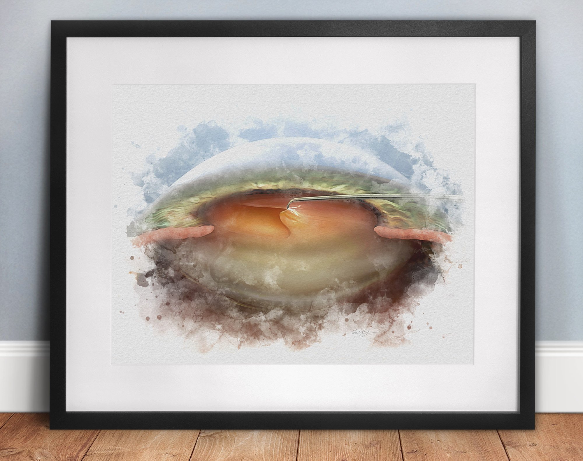Cataract surgeon gifts and wall art prints