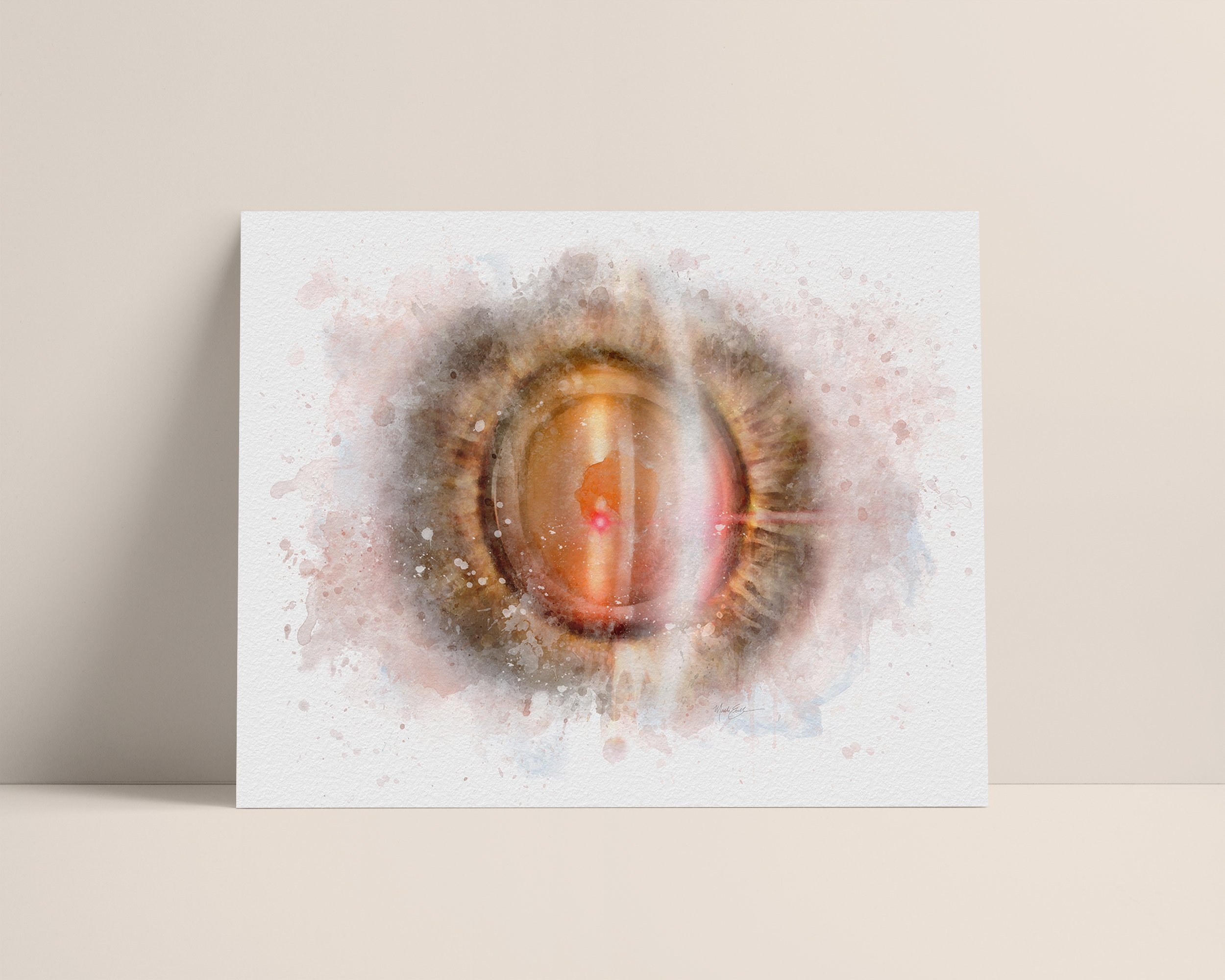 YAG laser art print illustrating YAG capsulotomy treatment - 240 yag laser art YAG laser art print