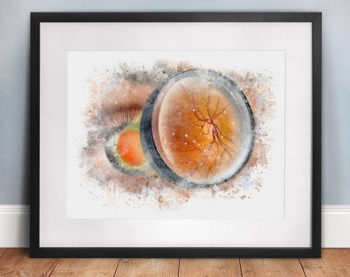 Eye exam art print gift for an optometrist