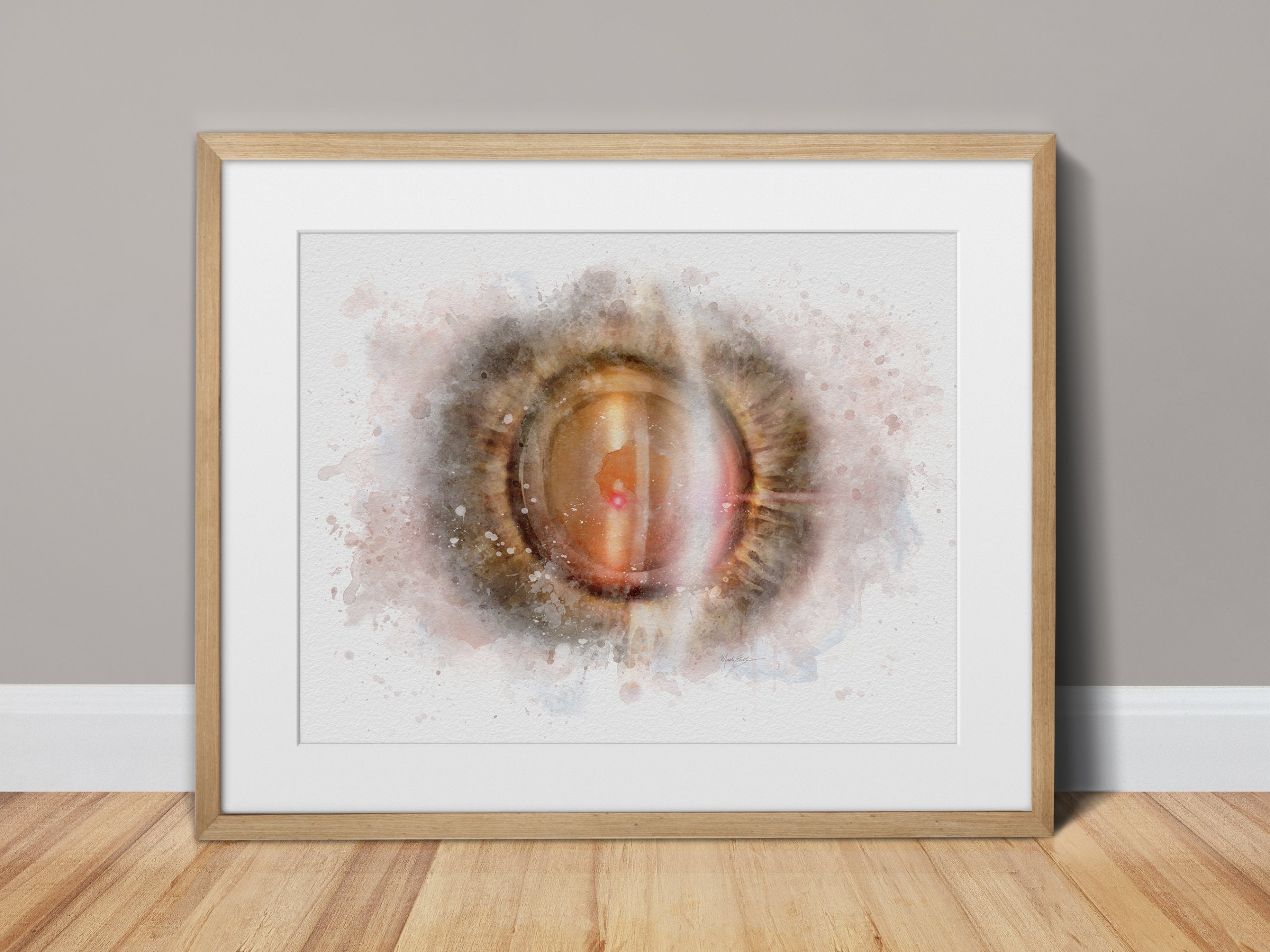 YAG laser art print illustrating YAG capsulotomy treatment - 240 yag laser art Laser eye art