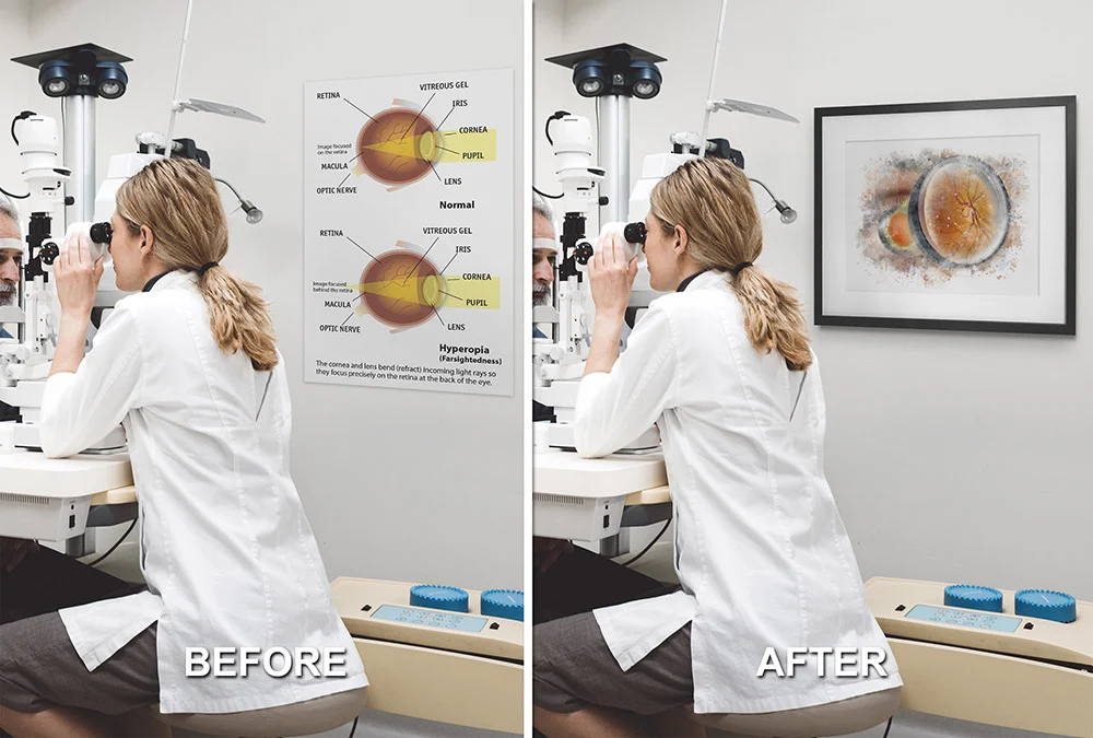 Ophthalmoscopy exam art print for eye care clinics and offices ophthalmoscopy exam Eye exam room wall art