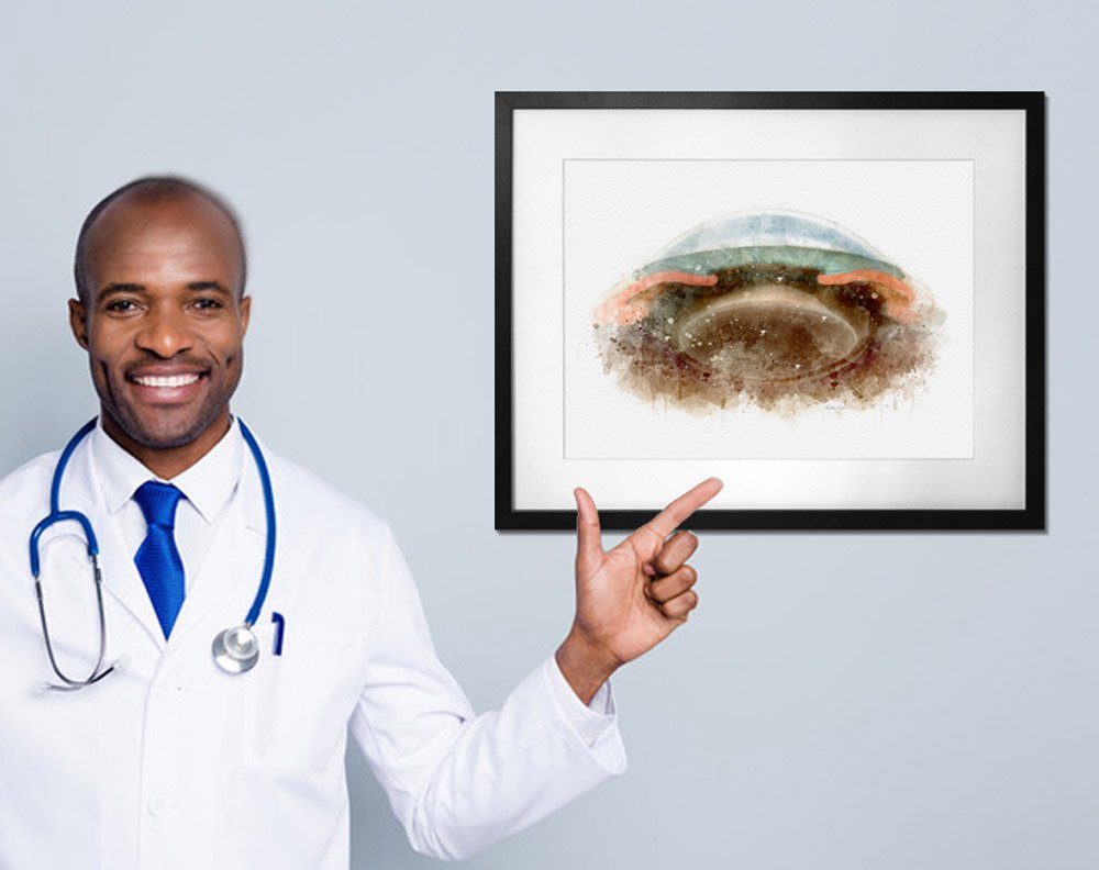 Anterior segment cross section art print for eye-care clinics anterior segment anatomy eye doctor wall art prints