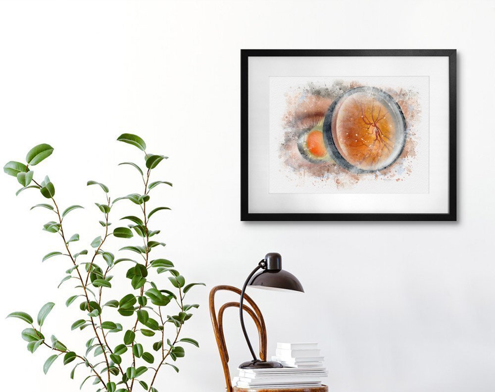 Ophthalmoscopy exam art print for eye care clinics and offices ophthalmoscopy exam Eye doctor wall art prints