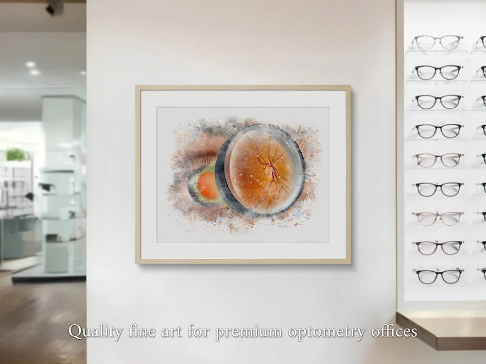 Ophthalmoscopy exam art print for eye care clinics and offices ophthalmoscopy exam Eye exam premium wall art