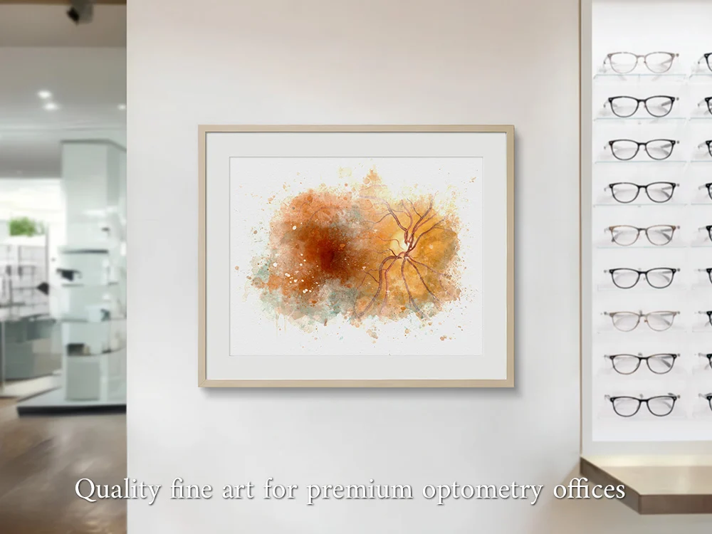 Retina anatomy art print for eye care offices and professional décor retina anatomy art Premium retina anatomy wall art print for optometrist decor