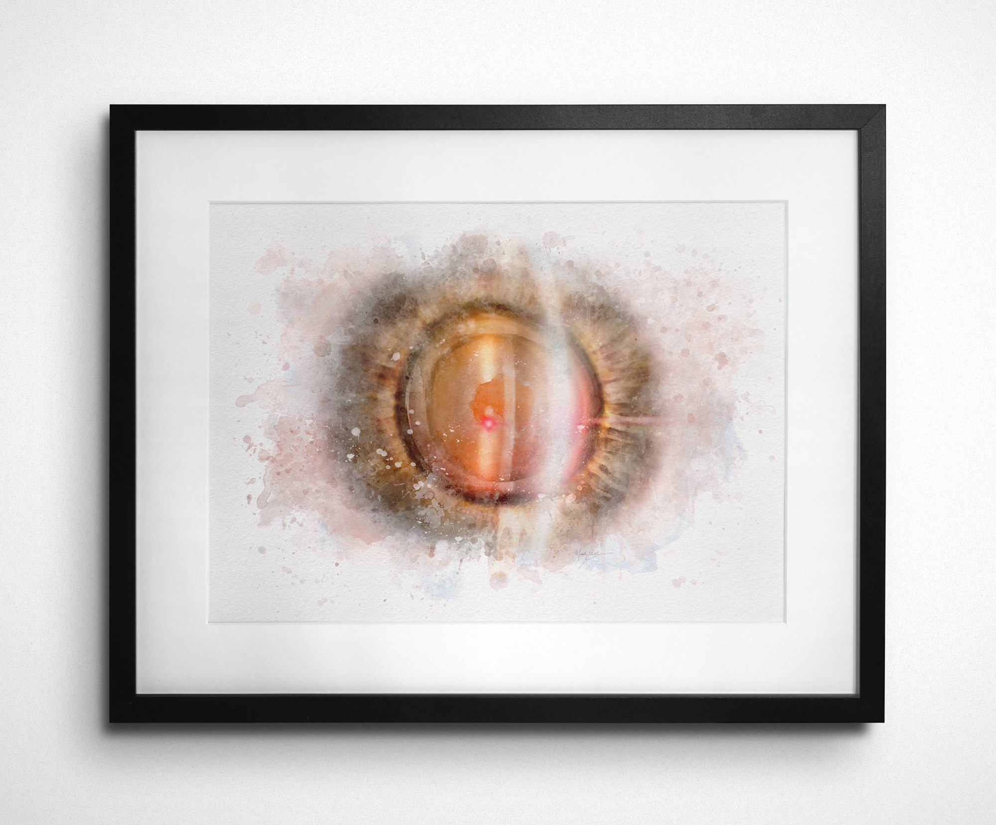 YAG laser art print illustrating YAG capsulotomy treatment - 240 yag laser art Laser eye surgery art