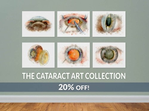 Cataract art prints collection