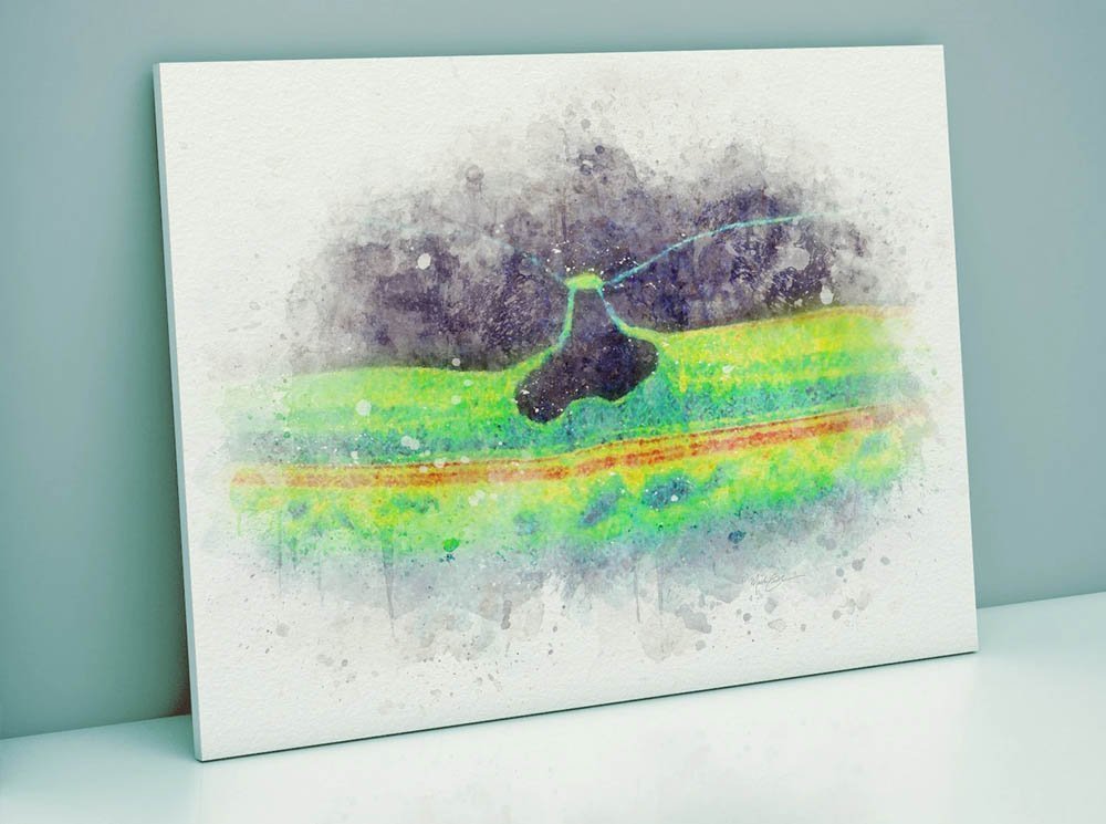 OCT scan art prints watercolor style art collection, all 4 prints for 20% off oct scan art OCT scan art prints watercolor style art collection, all 4 prints for 20% off - Image 4