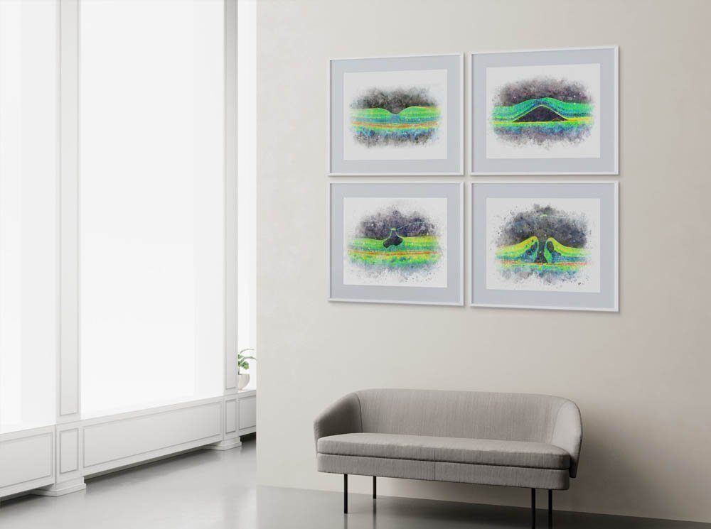 OCT scan art prints watercolor style art collection, all 4 prints for 20% off oct scan art OCT optical coherence art prints