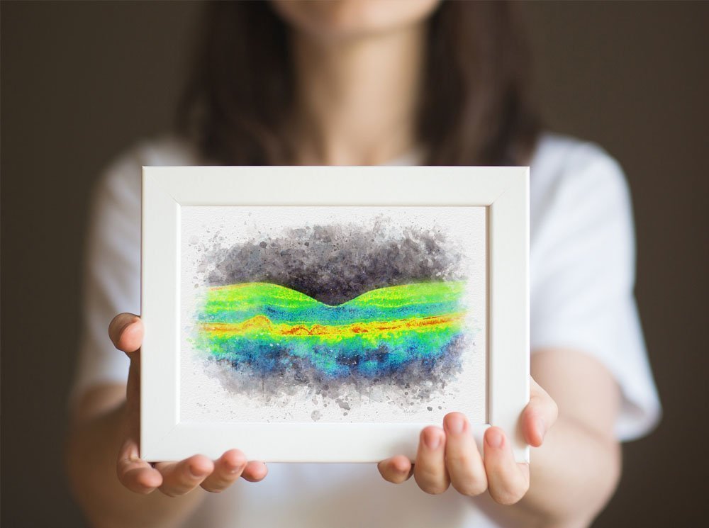 OCT drusen art print for eye-care clinics and offices oct drusen art gifts for optometrists
