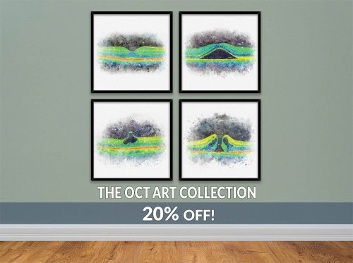 OCT scan art prints gifts for optometrists
