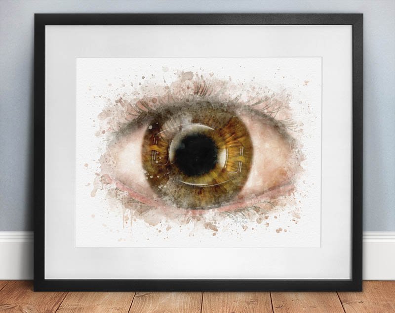 Iris fixed IOL art for eye surgeon decor