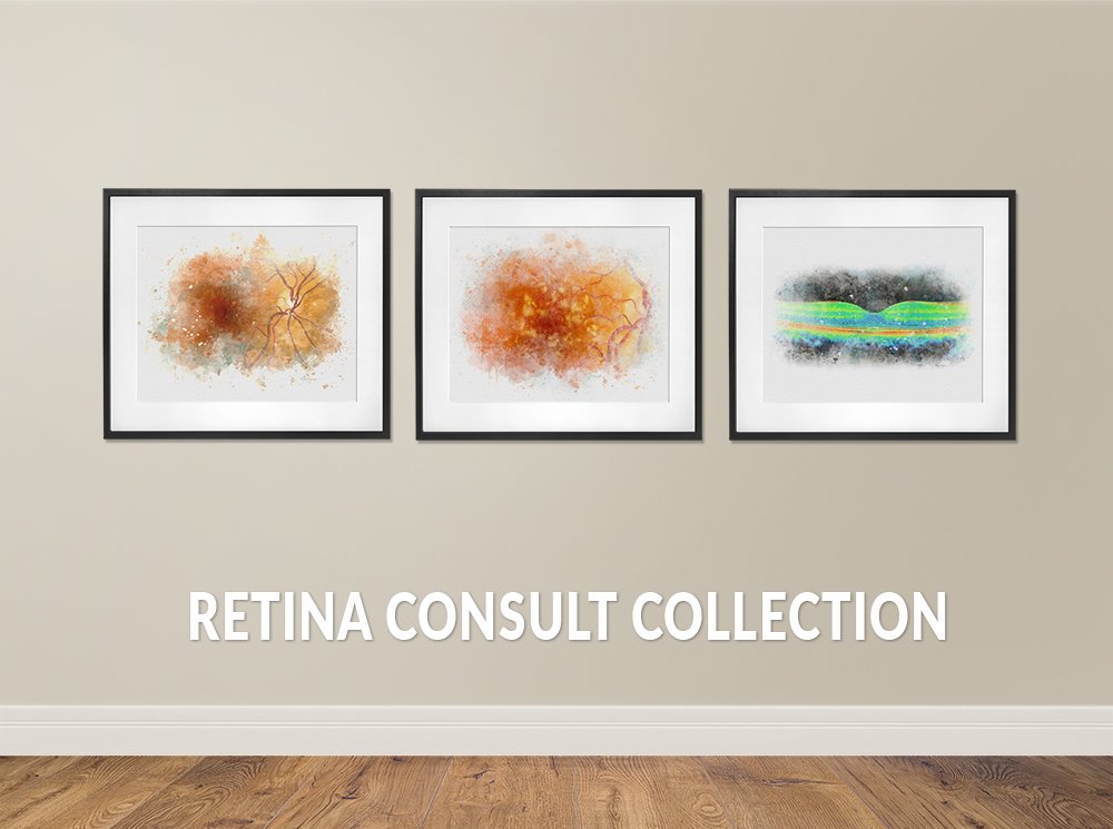 Retina consult room decor wall art prints